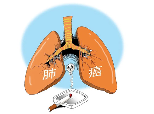 肺癌1.png